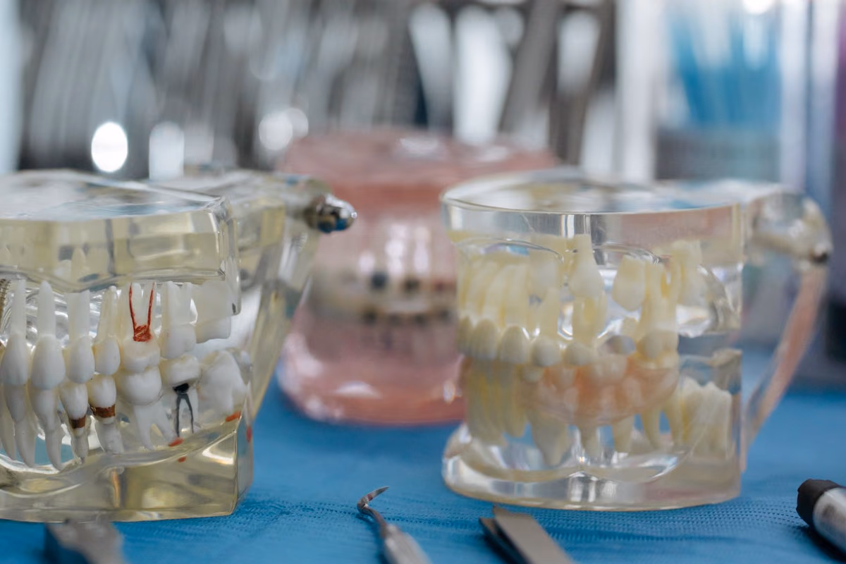 Transparent dental jaw models showing tooth roots set into the bone, illustrating the bone volume an implant needs to anchor into.