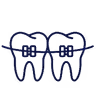 Dental braces treatment