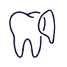 Porcelain veneers